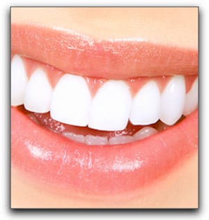 Whitening vs Bleaching At Dr. Bill Dorfman, DDS - Century City Aesthetic Dentistry In Los Angeles