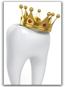 cost of dental crowns Beverly Hills