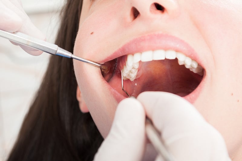 gum disease treatment Los Angeles