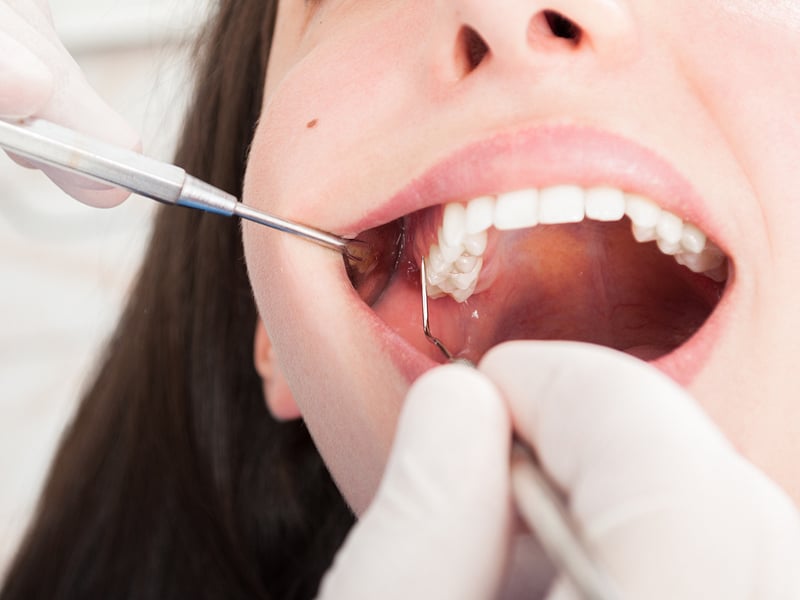 Cosmetic Dentistry in Los Angeles