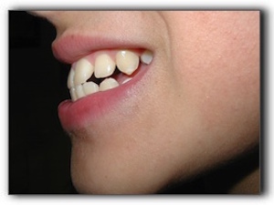 malocclusion examination Los Angeles