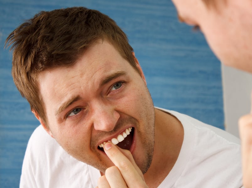 canker sore treatment Beverly Hills Stomatitis in Los Angeles