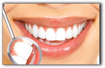 porcelain veneers cost Beverly Hills