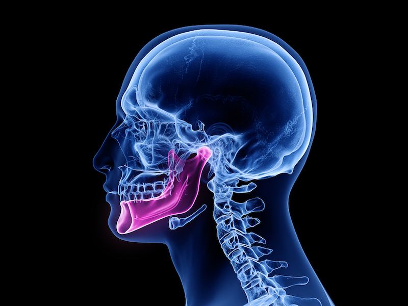 bone loss after tooth extraction 