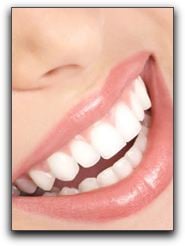 Affordable Los Angeles Cosmetic Dentistry