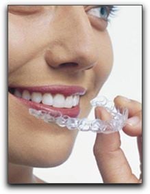 Cosmetic Dentistry In Beverly Hills:  Invisalign Can Straighten Those Teeth