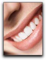 Zoom Whitening Los Angeles