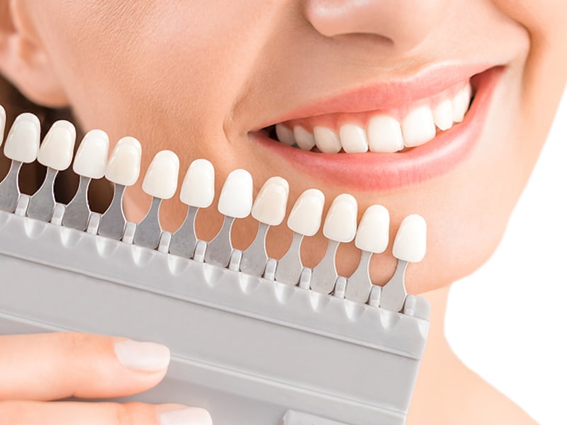 Los Angeles Teeth Bleaching