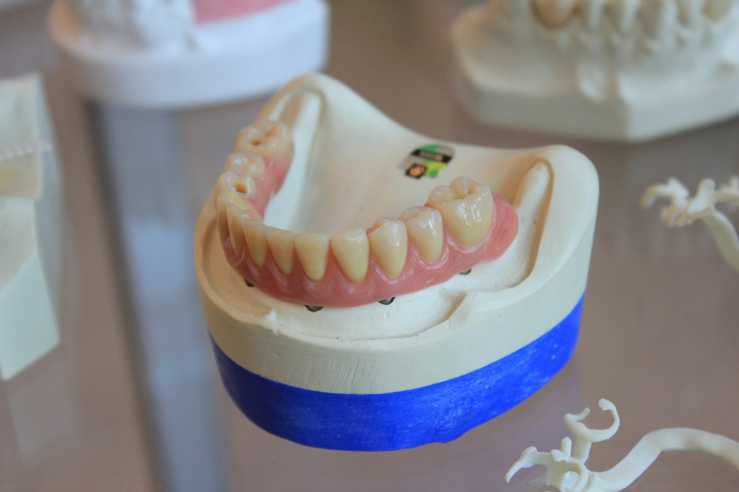 Implant-supported dentures — Dr. Bill Dorfman, Los Angeles
