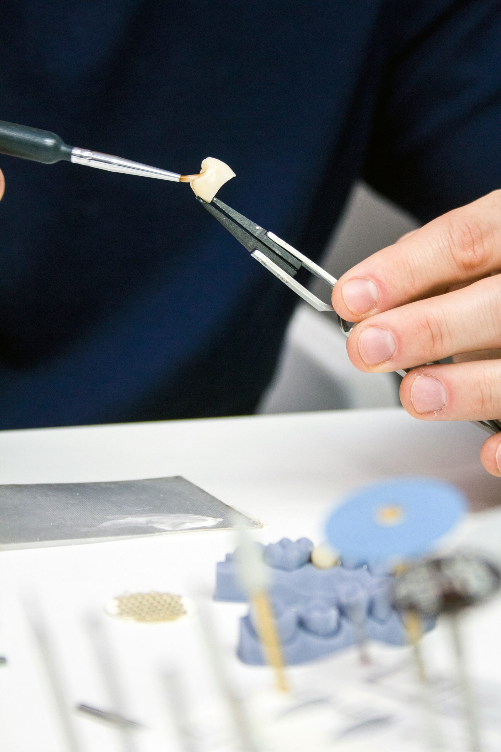 dental implant crown restoration by Dr Dorfman in Beverly Hills
