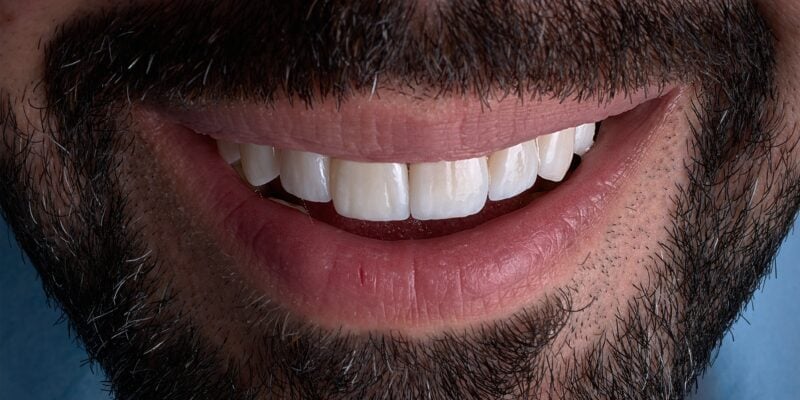 closeup of a mans white smile, professional teeth whitening