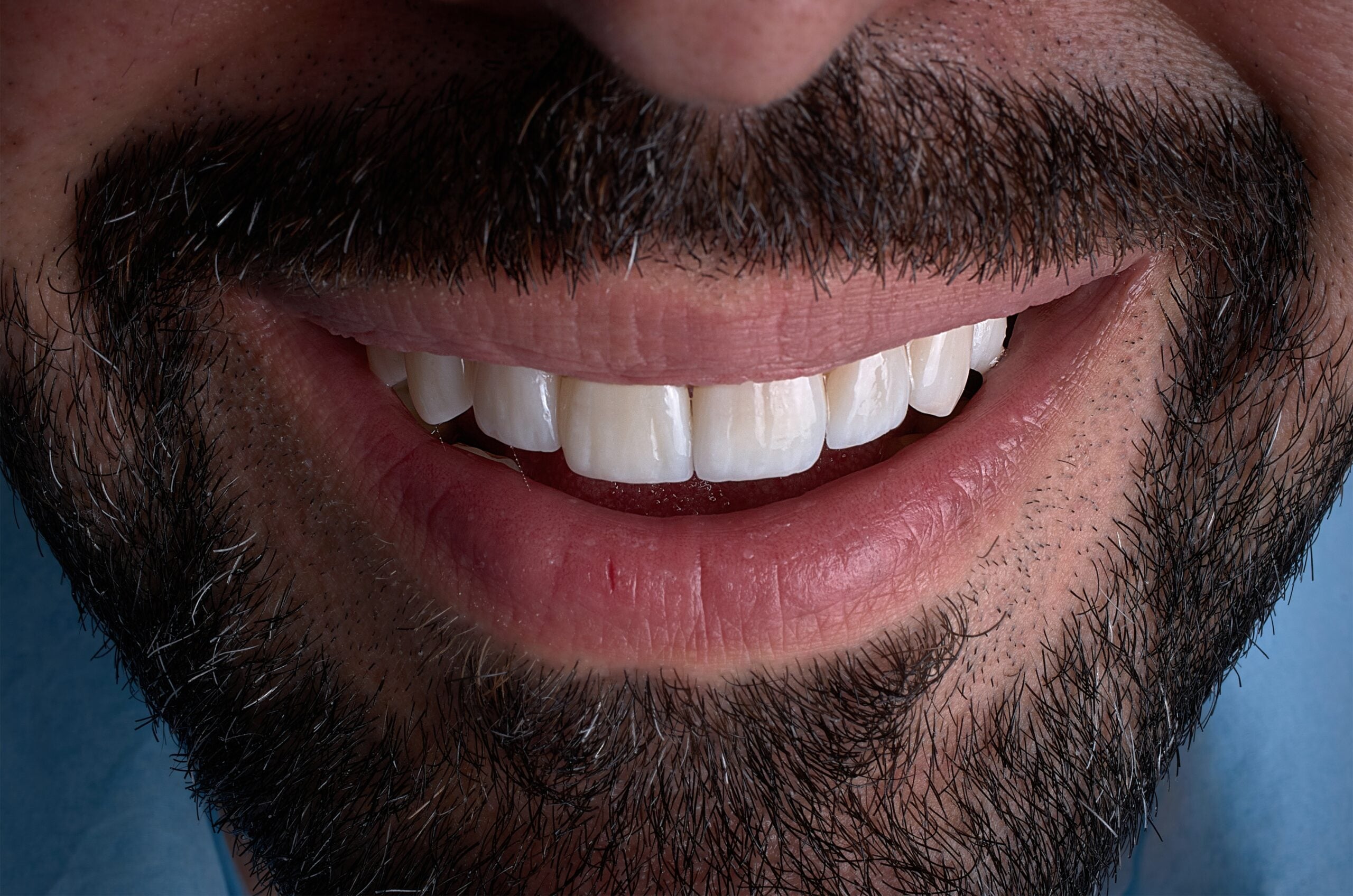 closeup of a mans white smile, professional teeth whitening